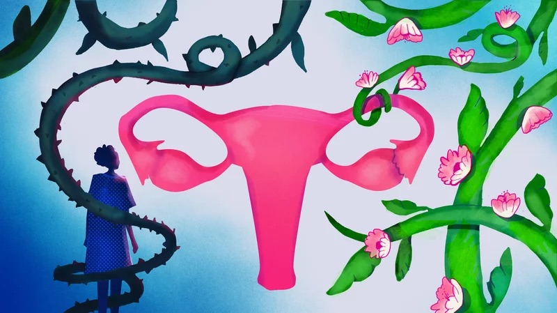 Graphic of uterus